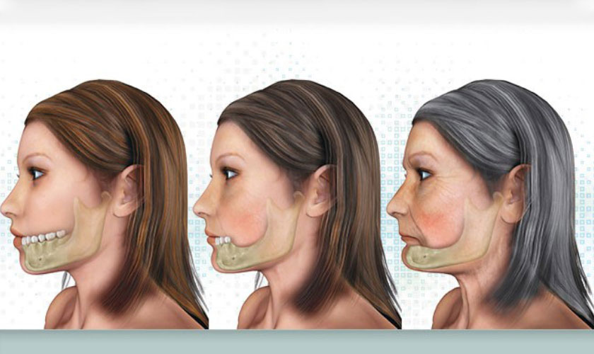 Tiêu xương răng là gì? Dấu hiệu, nguyên nhân và cách phòng ngừa 4 phong-ngua-va-dieu-tri-tieu-rang