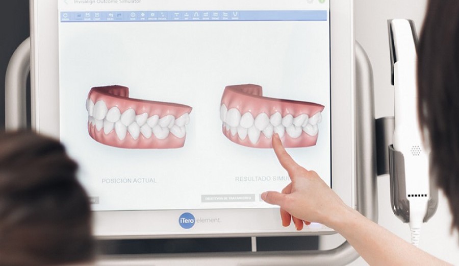 Trước Khi Niềng Răng Cần Chuẩn Bị Gì? 3 Xac-dinh-tinh-trang-rang-mieng-truoc-khi-nieng-rang