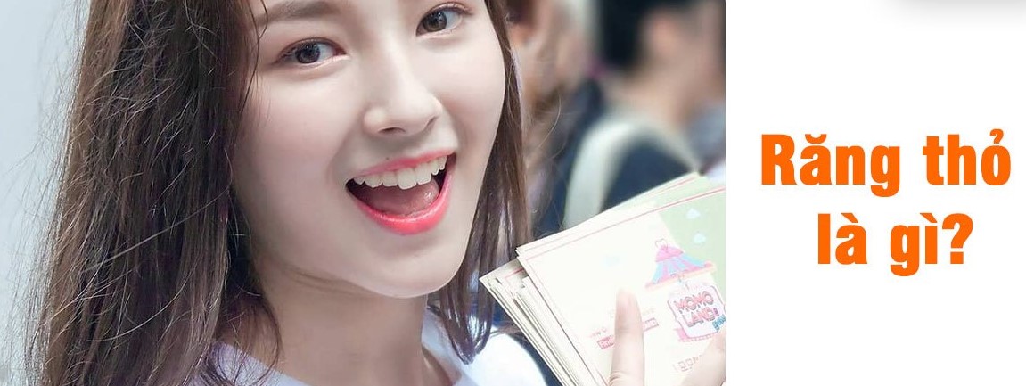 Răng thỏ – Xu hướng thẩm mỹ răng mới tại Nha khoa 5Brothers 1 rang-tho-la-gi