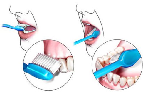 Cạo vôi răng an toàn, sạch sâu, không đau tại nha khoa 3 cham-soc-rang-mieng-sau-khi-cao-voi-rang