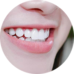 Bọc răng sứ 2 tham my