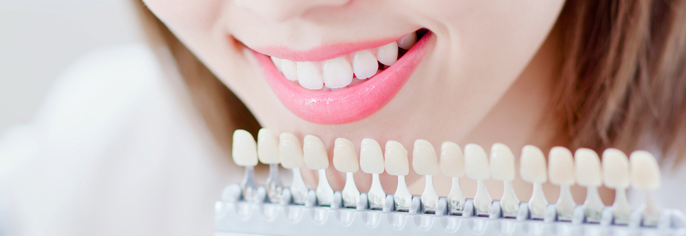 Giải pháp làm trắng răng an toàn tại Nha khoa 5BROTHERS 1 trang-rang-là-gi