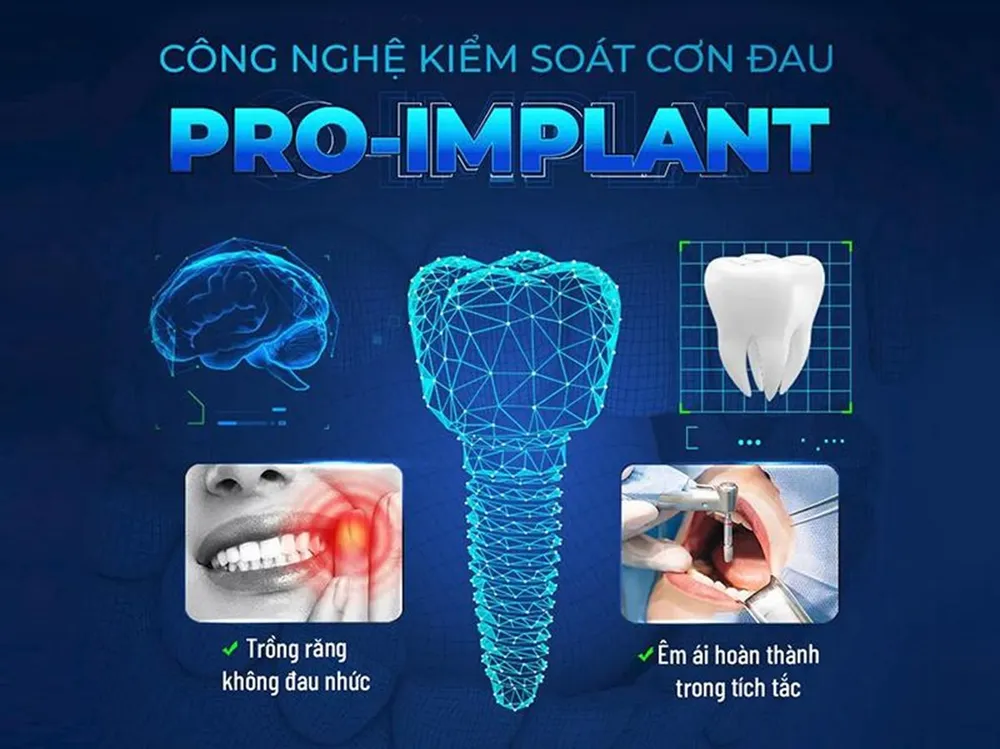 Nha Khoa 5Brothers Ứng Dụng Công Nghệ Dẫn Đầu Châu Âu Trong Cấy Ghép Implant Chính Xác Không Đau 1 cay-ghep-implant-truyen-thong